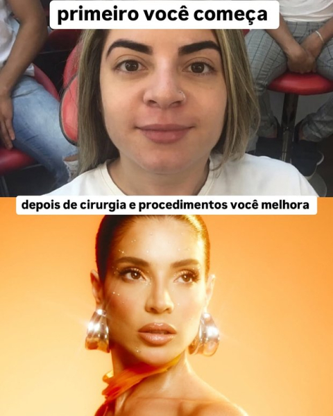 Блогерша изменилась до неузнаваемости из-за пластики и с трудом вернулась домой