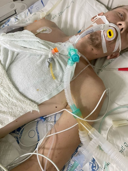 Российский турист попал в аварию в Таиланде, разорвал легкие и впал в кому. Ему срочно нужна помощь