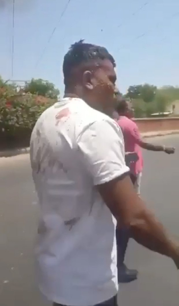 Один человек чудом выжил в авиакатастрофе в Индии. Кто он и в каком состоянии?