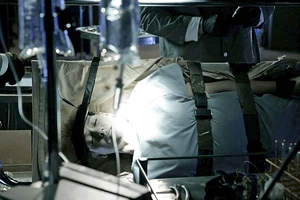 Мужчина начал часто вставать ночью в туалет и оказался болен раком